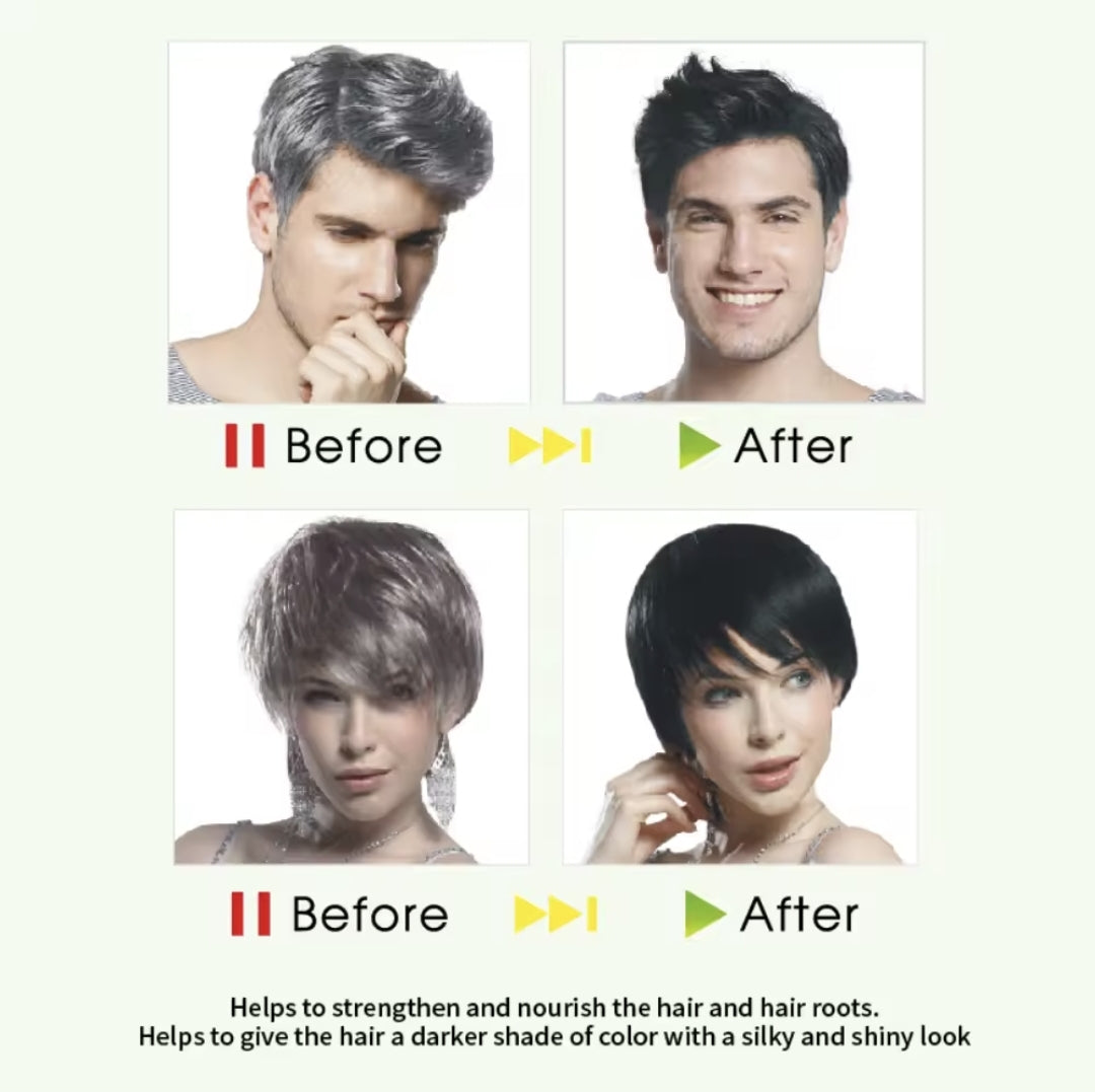 ደክስ ጸሊም ጸጉሪ ሻምፖ 400ml